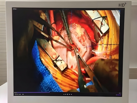 15 Inch Medical Monitor